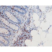 CD8